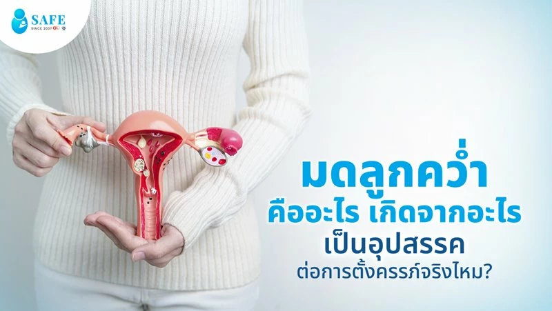 มดลูกคว่ำคืออะไร เกิดจากอะไร เป็นอุปสรรคต่อการตั้งครรภ์จริงไหม?