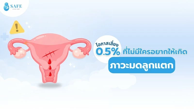 ภาวะมดลูกแตกคืออะไร? รู้จัก 4 สัญญาณเตือนที่ว่าที่คุณแม่ต้องเฝ้าระวัง