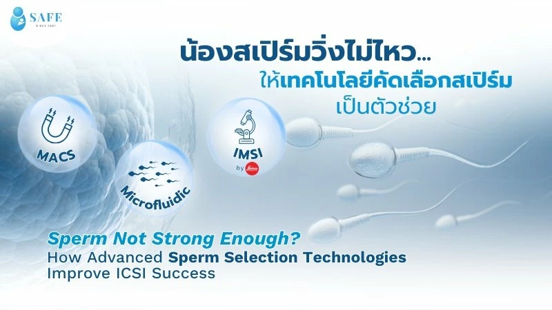 3 เทคโนโลยีช่วยคัดสเปิร์มตัวดี ตัวเด่น พร้อมปฏิสนธิสำหรับ ICSI