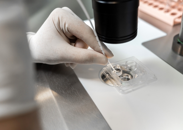 การย้ายตัวอ่อน