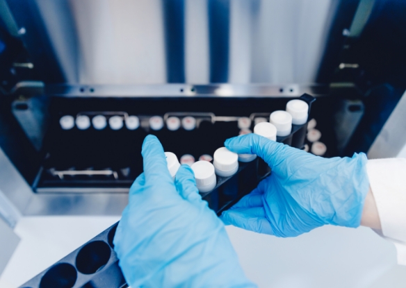 การแช่แข็งอสุจิ