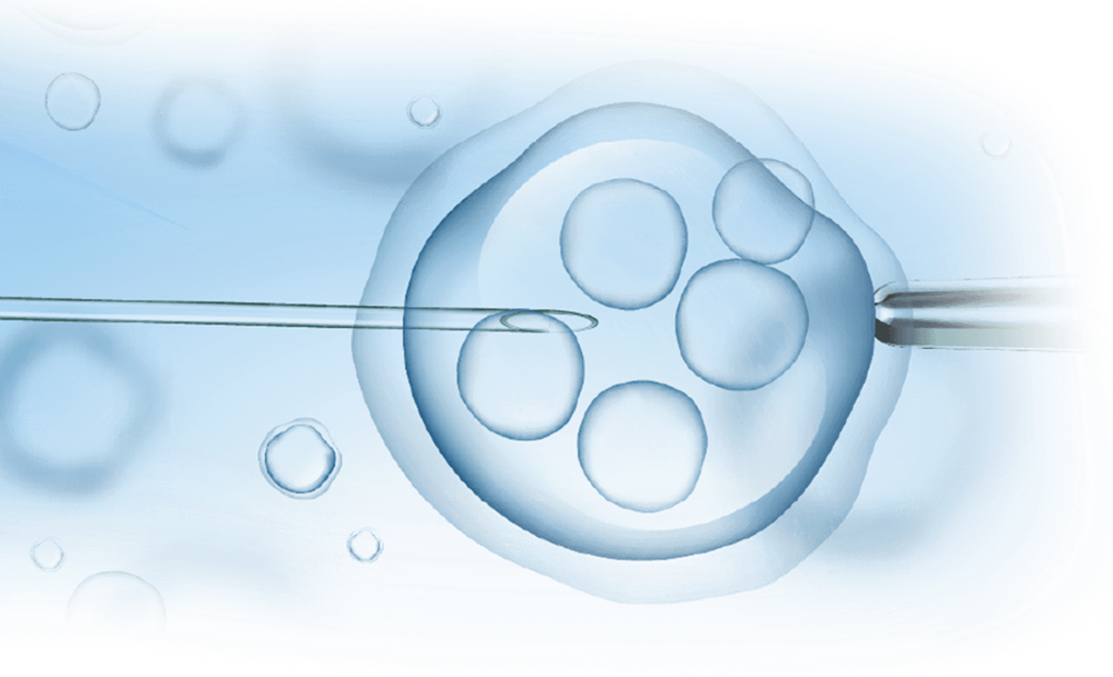 ใครเหมาะกับการทำ ICSI