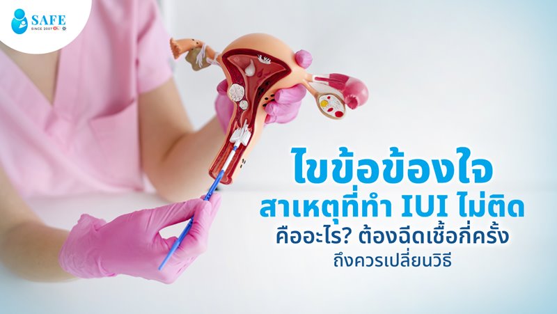 ไขข้อข้องใจ สาเหตุที่ทำ IUI ไม่ติดคืออะไร? ต้องฉีดเชื้อกี่ครั้งถึงควรเปลี่ยนวิธี