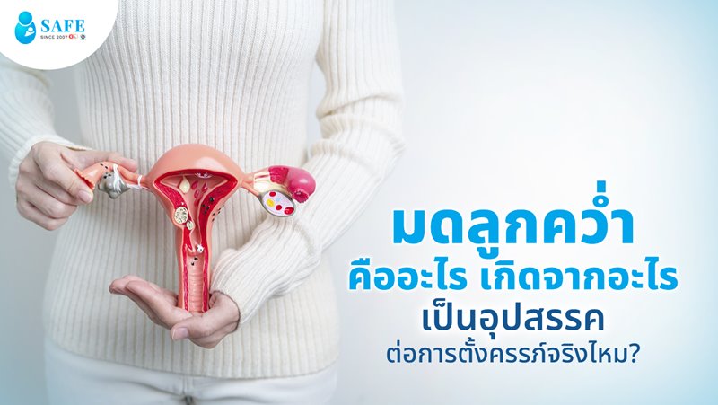 มดลูกคว่ำคืออะไร เกิดจากอะไร เป็นอุปสรรคต่อการตั้งครรภ์จริงไหม?