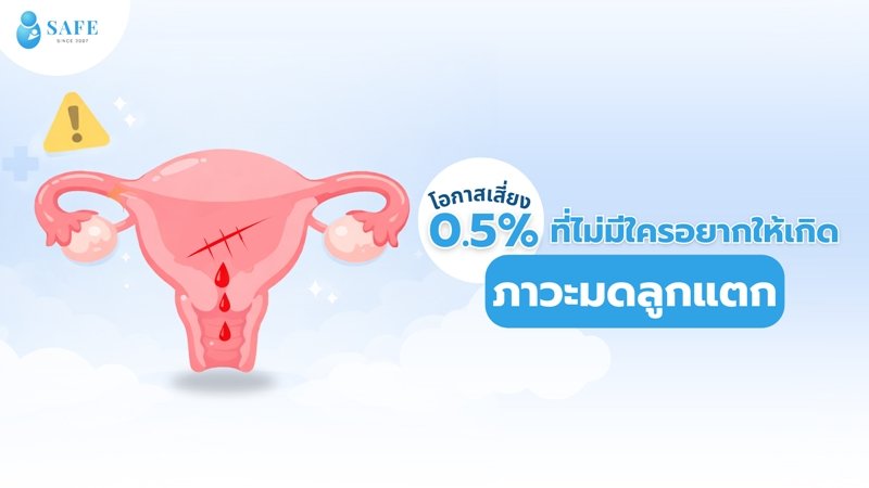 ภาวะมดลูกแตกคืออะไร? รู้จัก 4 สัญญาณเตือนที่ว่าที่คุณแม่ต้องเฝ้าระวัง