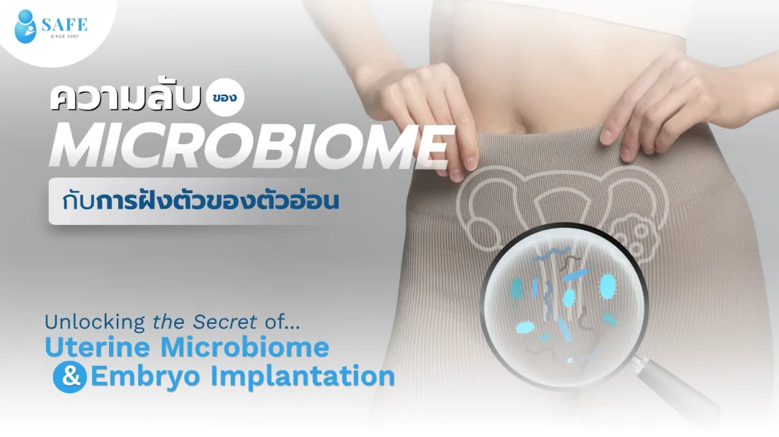 รู้จักกับ Microbiome ระบบนิเวศในโพรงมดลูก ที่มีส่วนช่วยในความสำเร็จ IVF/ICSI สำหรับผู้ที่ย้ายตัวอ่อนไม่ติดซ้ำ ๆ